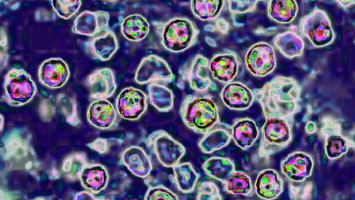 Pennsylvania Measles Outbreak Escalates with Tragic Fatality